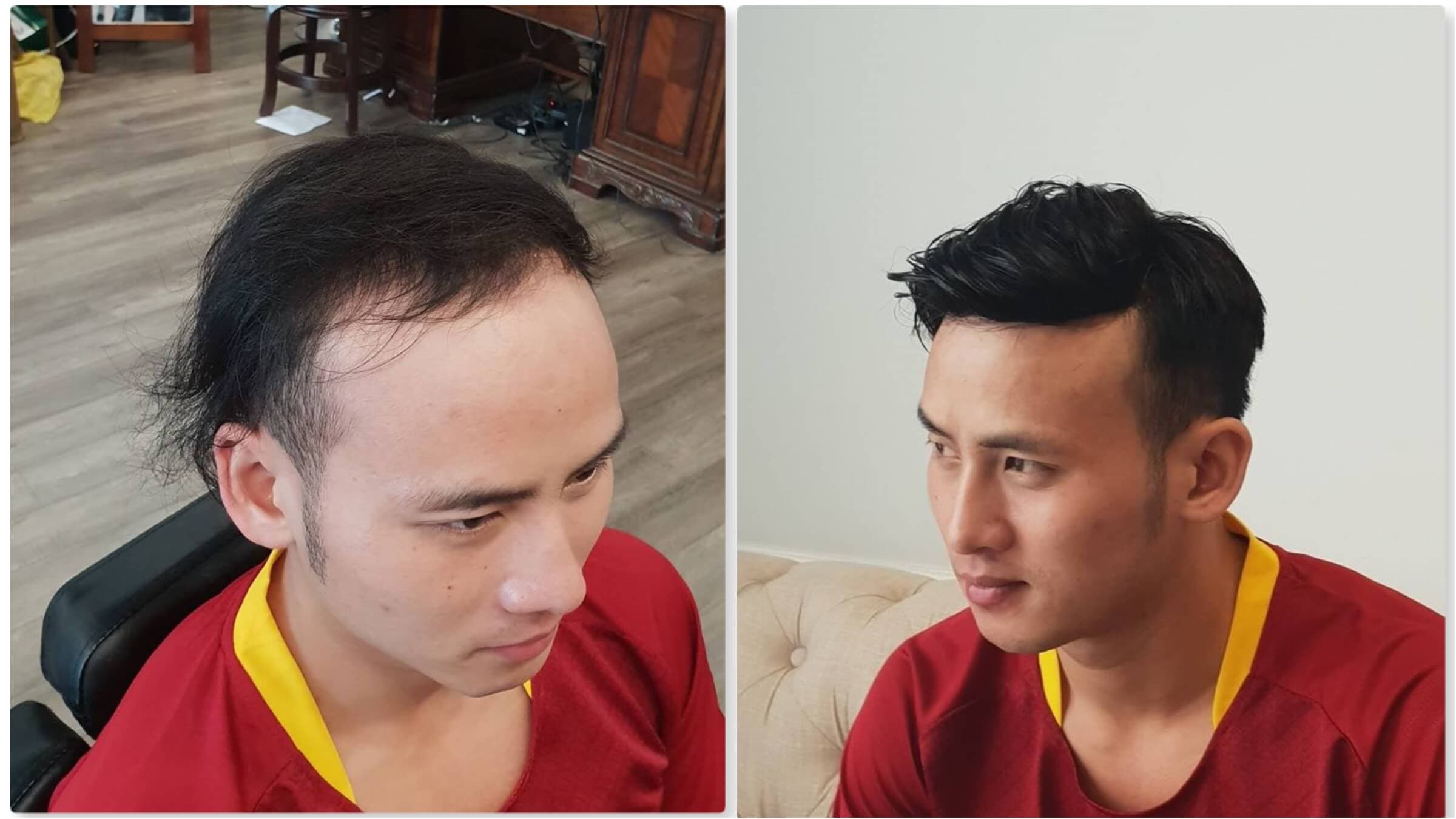 Sử dụng tóc giả có tốt không?