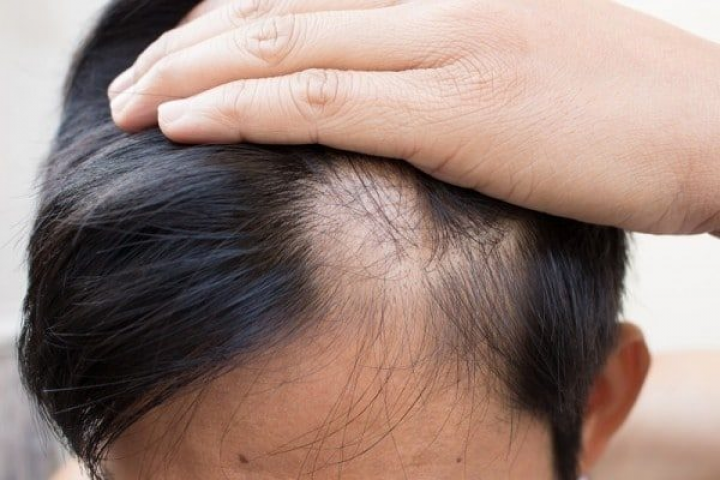 VTG Smart Hair &#8211; Thương hiệu tóc giả số 1 Việt Nam