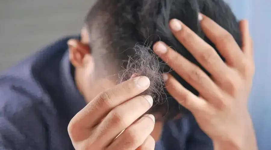 Mẹo trị rụng tóc tại nhà đơn giản mà anh cần biết