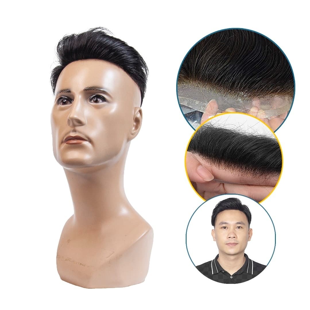 Tóc thẩm mỹ D10 &#8211; Giải pháp che hói cho người trán cao
