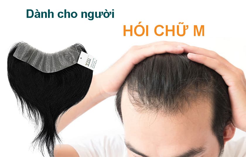 TOP 18+ kiểu tóc nam dành cho trán hói chữ M