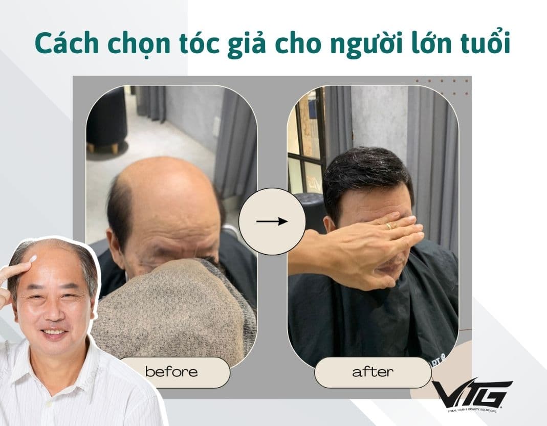 Hướng Dẫn Cách Chọn Tóc Giả Cho Người Lớn Tuổi, Người Già Phù Hợp