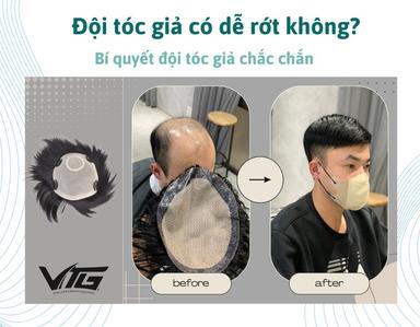 Đội Tóc Giả Có Dễ Rớt Không? Cách Đội Tóc Giả Chắc Chắn Nhất