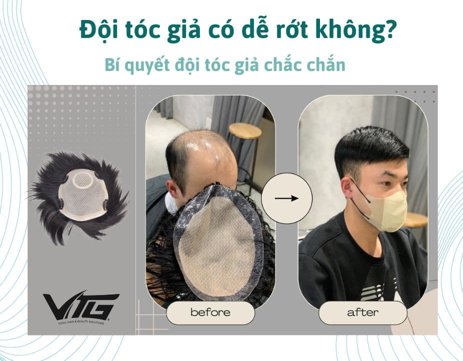 Đội Tóc Giả Có Dễ Rớt Không? Cách Đội Tóc Giả Chắc Chắn Nhất