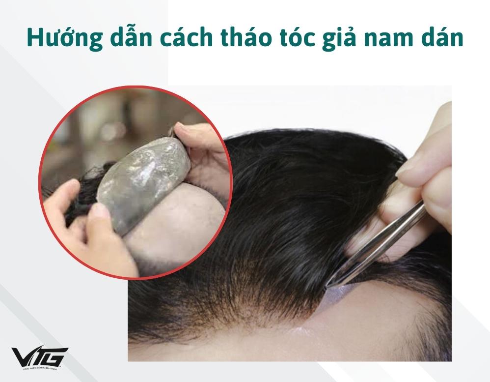 Hướng Dẫn Tháo Tóc Giả Dạng Dán Đơn Giản, Nhẹ Nhàng