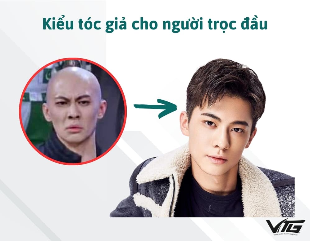Trọc Đầu Có Đội Tóc Giả Được Không? 5 Kiểu Tóc Giả Cho Người Trọc Đầu