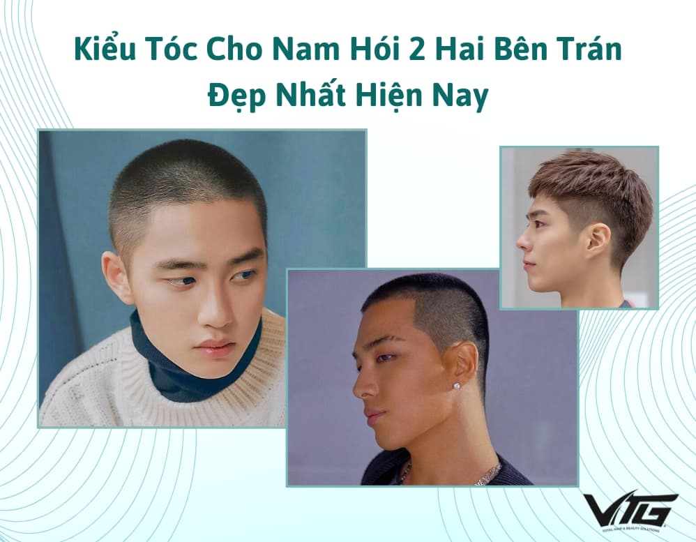 TOP 10+ Kiểu Tóc Cho Nam Hói 2 Hai Bên Trán Đẹp Nhất Hiện Nay