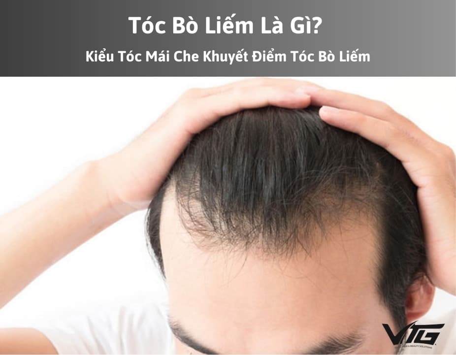 Tóc Bò Liếm Là Gì? Kiểu Tóc Mái Che Khuyết Điểm Tóc Bò Liếm