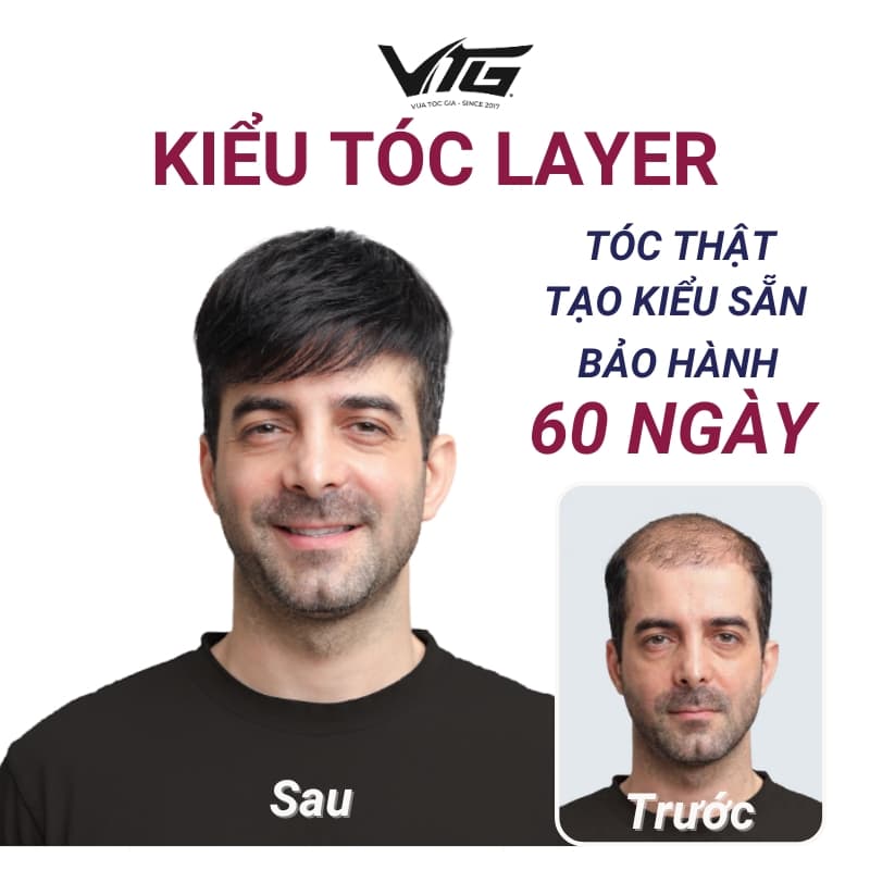 Tóc giả nam Layer giá rẻ từ sợi tóc tự nhiên