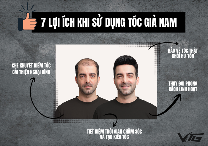 7 Lợi Ích Khi Sử Dụng Tóc Giả Nam Có Thể Bạn Chưa Biết
