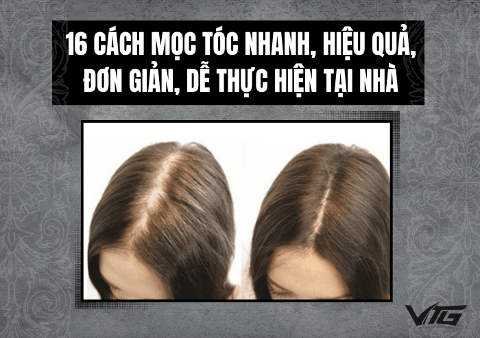 16 Cách Mọc Tóc Nhanh, Hiệu Quả, Đơn Giản, Dễ Thực Hiện Tại Nhà