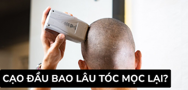 Cạo Đầu Bao Lâu Tóc Mọc Lại? Cách Giúp Tóc Mọc Lại Nhanh Hơn
