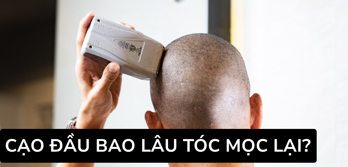 Cạo Đầu Bao Lâu Tóc Mọc Lại? Cách Giúp Tóc Mọc Lại Nhanh Hơn