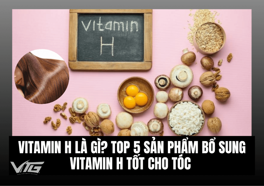 Vitamin H Là Gì? Top 5 Sản Phẩm Bổ Sung Vitamin H Tốt Cho Tóc