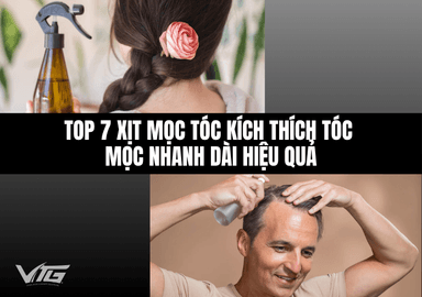 TOP 7 Xịt Mọc Tóc Kích Thích Tóc Mọc Nhanh Dài Hiệu Quả