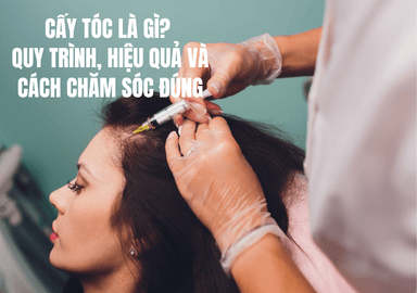 Cấy Tóc Là Gì? Quy Trình, Hiệu Quả Và Cách Chăm Sóc Đúng