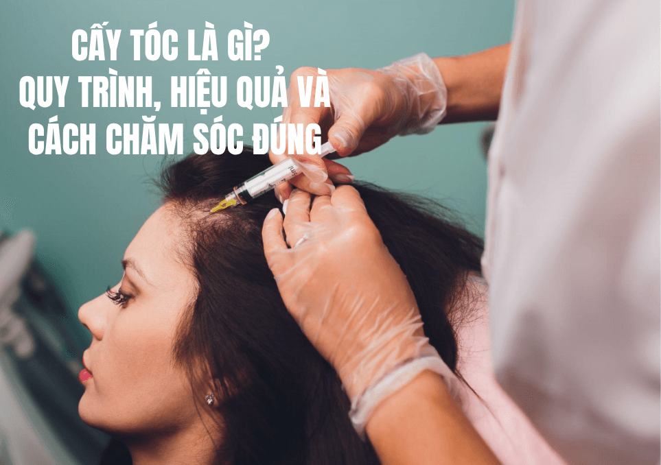 Cấy Tóc Là Gì? Quy Trình, Hiệu Quả Và Cách Chăm Sóc Đúng