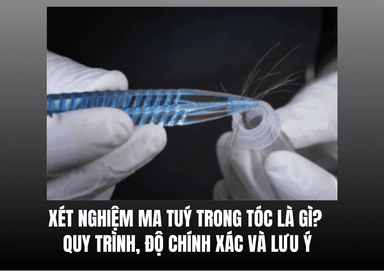 Xét Nghiệm Ma Tuý Trong Tóc Là Gì? Quy Trình, Độ Chính Xác Và Lưu Ý
