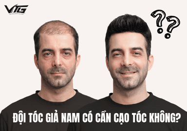 Đội Tóc Giả Nam Có Cần Cạo Tóc Không? Khi Nào Phải Cạo?