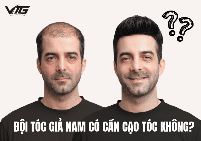 Đội Tóc Giả Nam Có Cần Cạo Tóc Không? Khi Nào Phải Cạo?