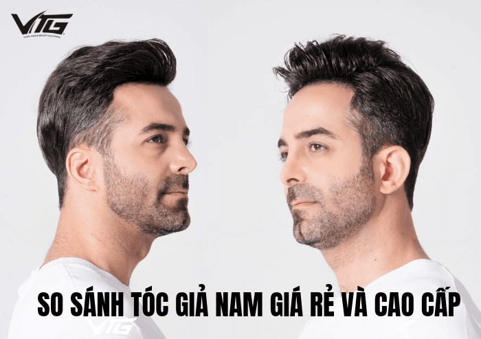 So Sánh Tóc Giả Nam Giá Rẻ Và Cao Cấp: Nên Mua Loại Nào?