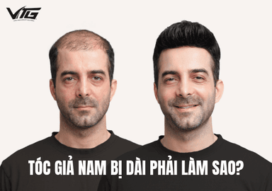 Tóc Giả Nam Bị Dài Phải Làm Sao? 3 Cách Xử Lý Chuẩn Đẹp Tự Nhiên