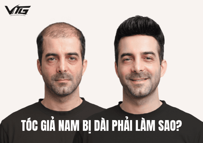 Tóc Giả Nam Bị Dài Phải Làm Sao? 3 Cách Xử Lý Chuẩn Đẹp Tự Nhiên