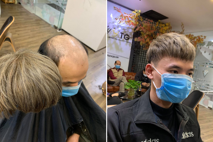 TOP Kiểu tóc nam mặt tròn trán cao che khuyết điểm 2024