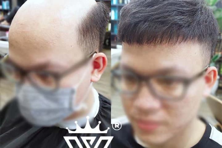 Mua tóc giả nam ở đâu? Địa chỉ mua tóc giả nam uy tín Hà Nội