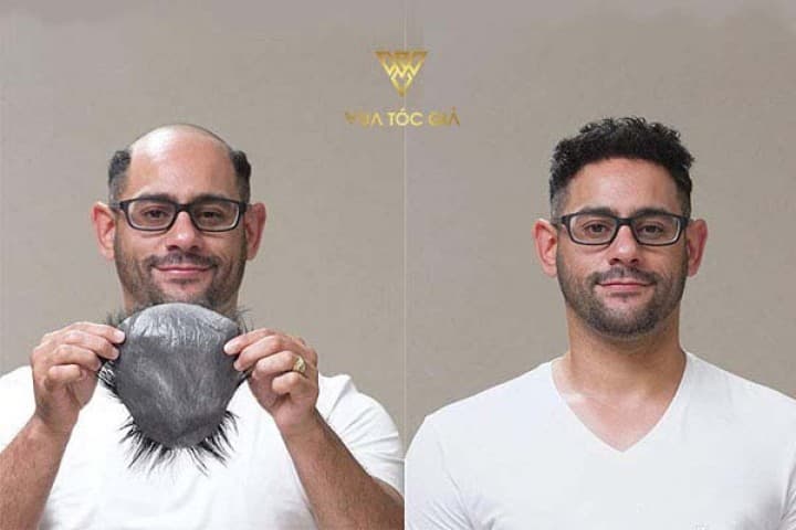 Kinh nghiệm đội tóc giả trông tự nhiên nhất