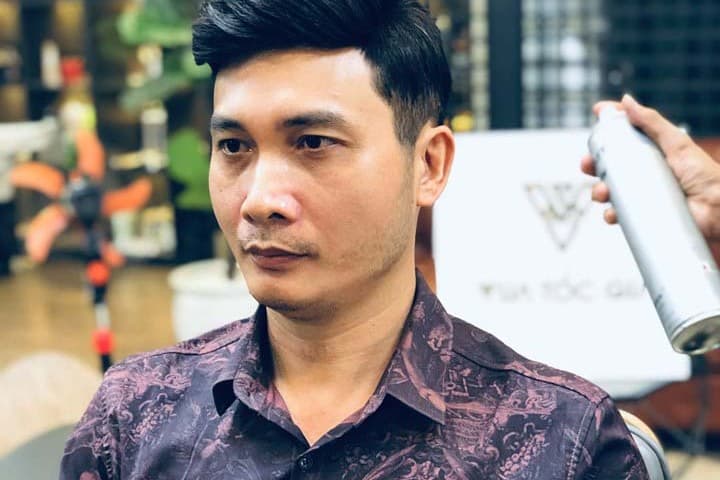 Tóc giả dán vào da đầu và những điều bạn chưa biết