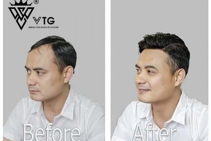 Mua tóc giả nam chất lượng ở đâu độ bền cao?