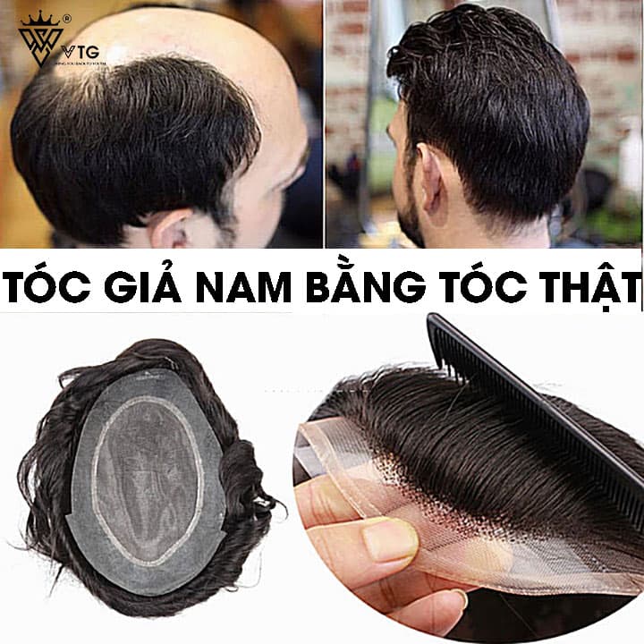 Những Câu Hỏi Thường Gặp Khi Dùng Tóc Giả Mà Bạn Nên Biết