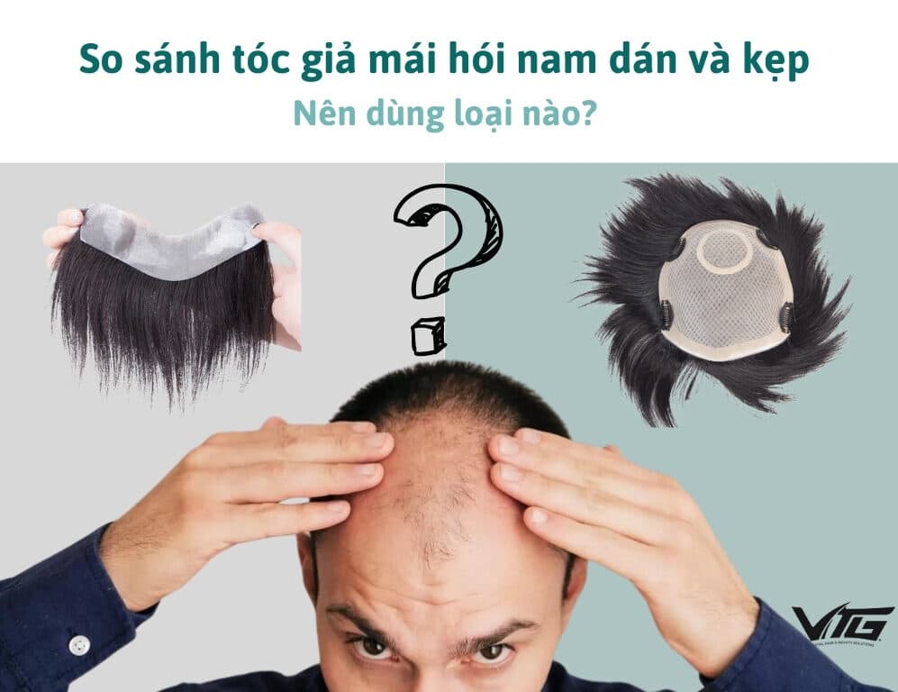 So Sánh Tóc Giả Nam Dạng Dán Và Kẹp, Nên Dùng Loại Nào?
