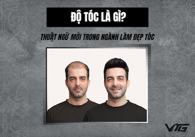 Độ Tóc Là Gì? Xu Hướng Giúp Nam Giới Lấy Lại Mái Tóc Dày Đẹp Tự Nhiên