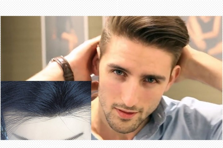 Nguy cơ lão hóa tóc da đầu ở nam giới tuổi 30  VnExpress Sức khỏe